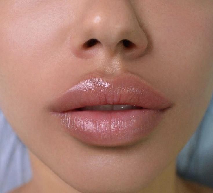 بررسی آگهی‌ها Lip Fillers Juvederm, Trucco Glam, Lips Inspiration, Face Fillers, Botox Lips, Facial Fillers, Facial Aesthetics, Lip Shapes, Lip Injections