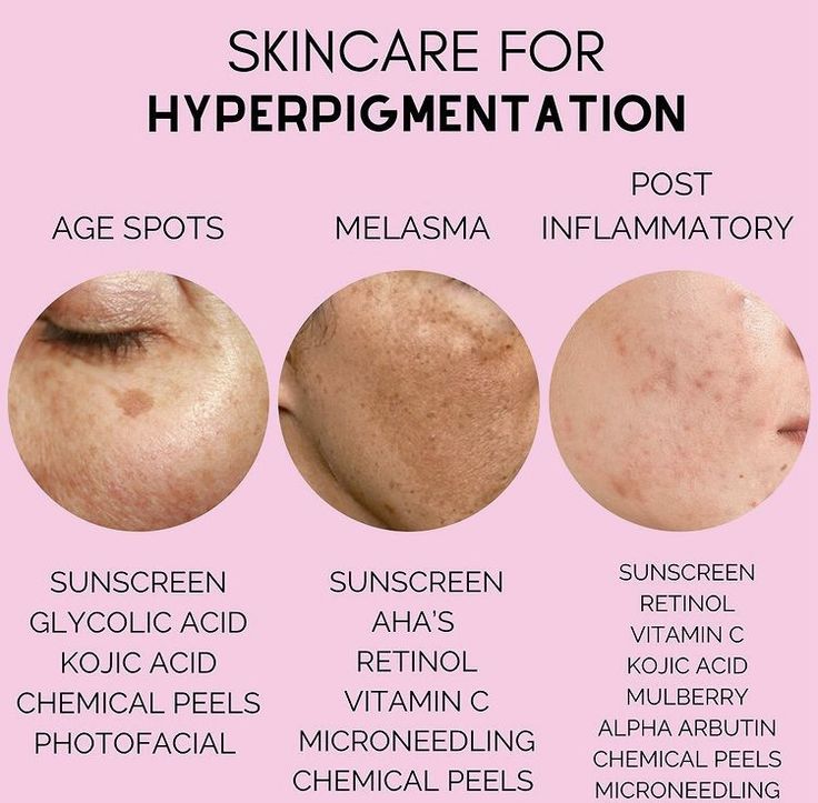 Haut Routine, Skin Facts, Skin Care Business, Skin Advice, Skin Care Routine Order, Skin Aesthetics, Basic Skin Care Routine, Perfect Skin Care Routine, Healthy Skin Tips