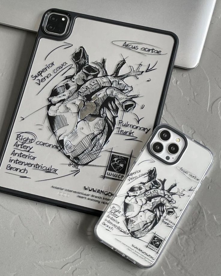 an iphone case with a drawing on it next to a cell phone and laptop computer