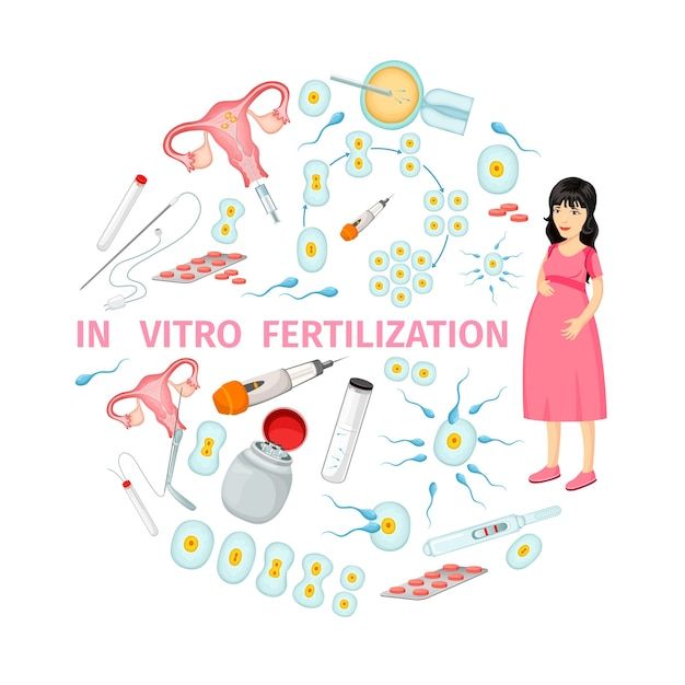 a pregnant woman surrounded by various types of utensils and other medical items in a circle with the words in virto fertiization