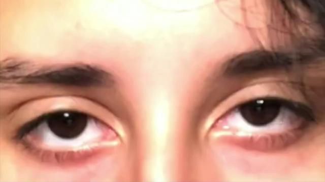 Demonic eyes ,sunpaku eyes Eye Claims For Dr Male, Eyes Looking At You, Downturned Eyes Reference, Sanpaku Eyes Men, Yin Sanpaku Eyes, Tired Eyes Men, Downturned Eyes Men, Sunken Eyes Aesthetic, Sleepy Eyes Men