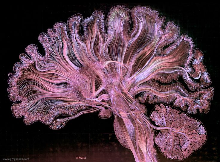 an image of the inside of a brain with pink filaments on black background