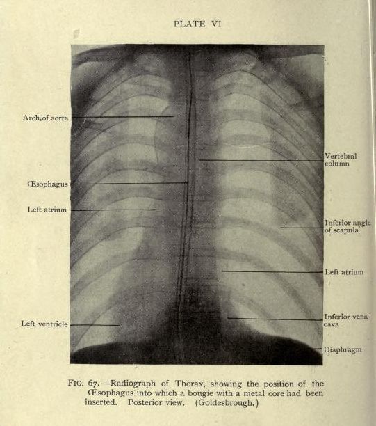 an old book with some diagrams about the chest and thorbones in black and white