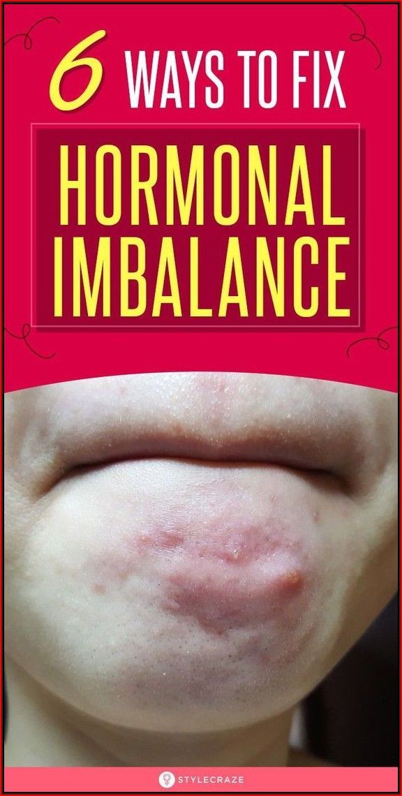 Fix Hormonal Imbalance, Low Estrogen Symptoms, Get Rid Of Pimples, Rid Of Pimples, Too Much Estrogen, Low Estrogen, Womens Health Care, Hormonal Imbalance, Women Health Care