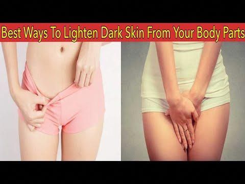 In this video you will learn How to Lighten Dark Skin From Your Body Parts, And Around Your Pubic Area.There are many reasons which causes dark skin problem ... Dark Inner Thighs, Skin Lightening Diy, Homemade Cosmetics, Healthy Lifestyle Quotes, Skin Spots, Lighter Skin, Saggy Skin, Skin Lightening, Female Fitness Model