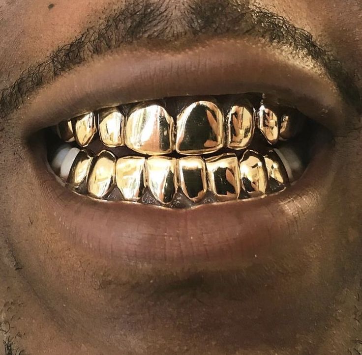 𝔉𝔬𝔩𝔩𝔬𝔴 𝖋𝖔𝖗 𝖒𝖔𝖗𝖊 𝖕𝖎𝖓𝖘🦋 Gold Slugs, Gold Teeth Grills, Mouth Grills, Gold Grills, Teeth Grills, Teeth Aesthetic, Teeth Gems, Teeth Drawing, Grillz Teeth