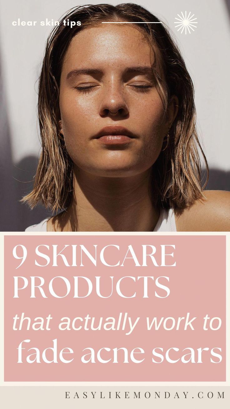 How to Get Rid of Acne Scars and Improve Uneven Skin Tone. The ultimate list of skincare products to heal acne scars quickly and simply. Aging Skin Remedies, Witch Hazel Acne, Acne Scar Remedies, Cystic Acne Remedies, Acne Scaring, Acne Scarring, Get Rid Of Acne, Rid Of Acne, Reduce Hyperpigmentation