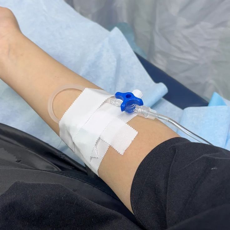 a person with an iv attached to their arm