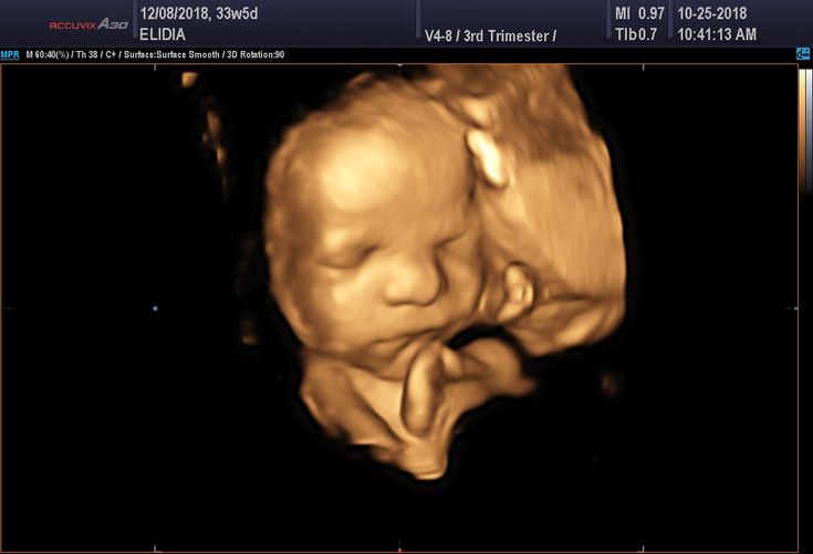 a blurry image of a baby's head in the middle of its mouth