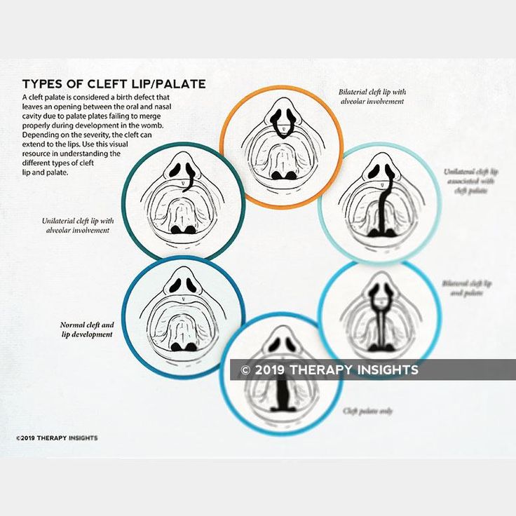 the five types of clipplates are shown in three circles with different colors