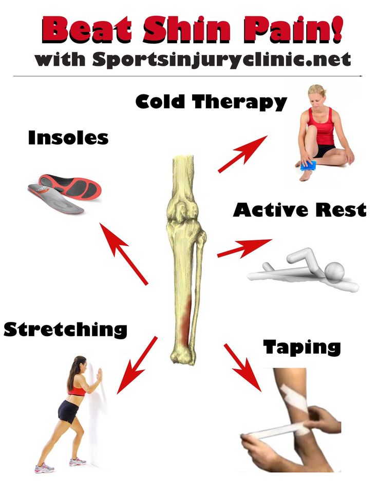 Shin Splints Exercises, Shin Splint Exercises, Sport Injuries, Runner Problems, Running Injuries, Shin Splints, Mobility Exercises, Athletic Training, Sports Injury