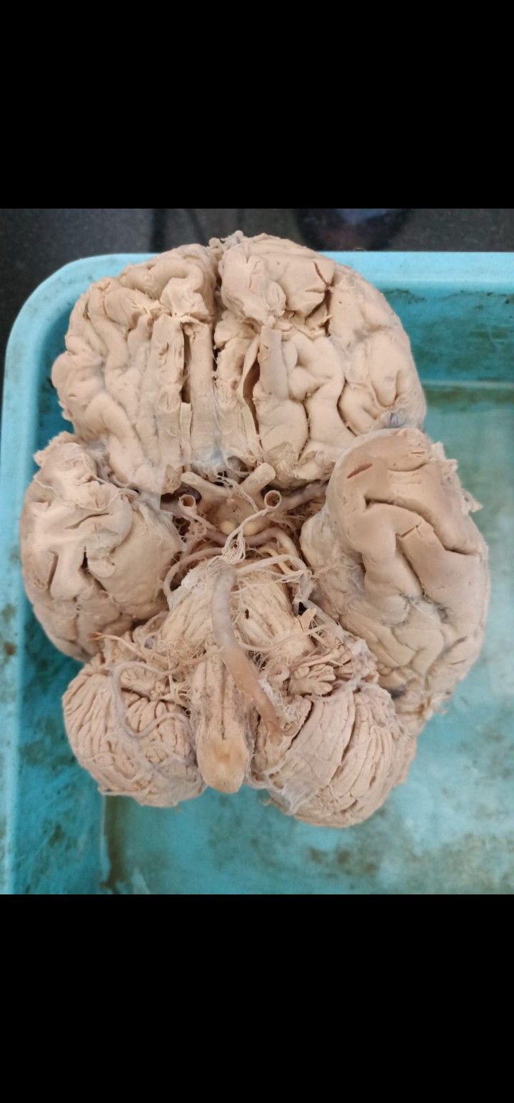 a close up of a human brain on a tray