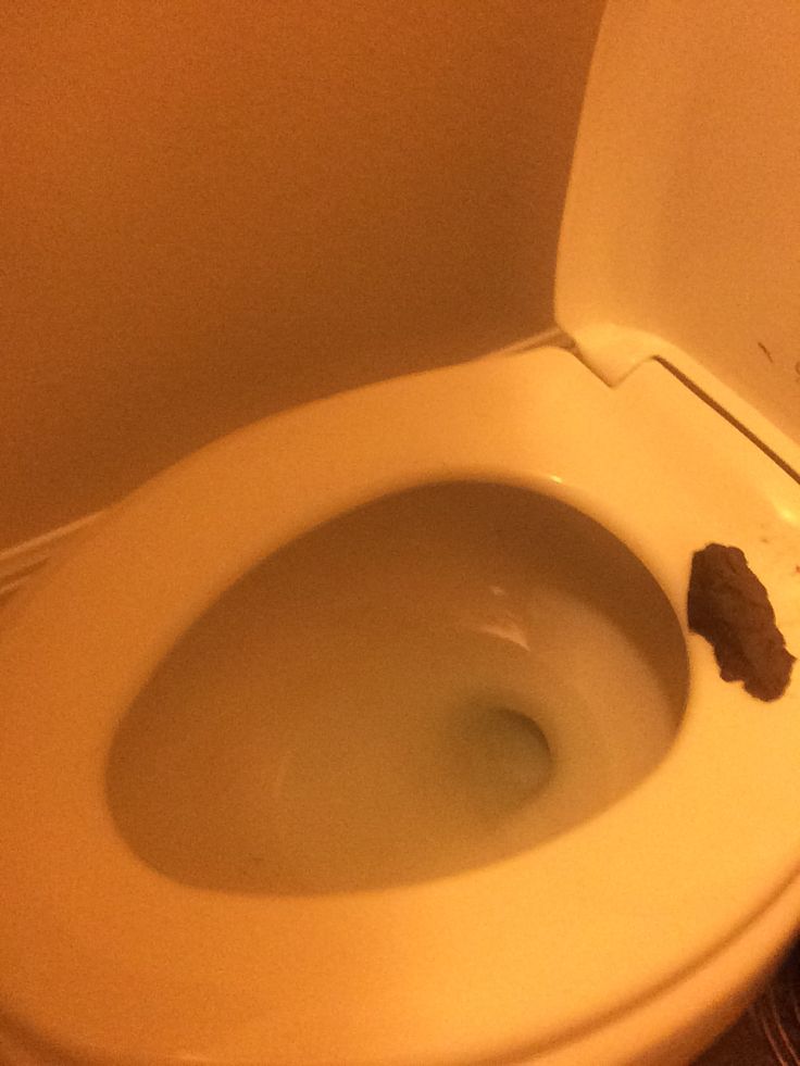 a white toilet with the lid up and some brown stuff on it's side