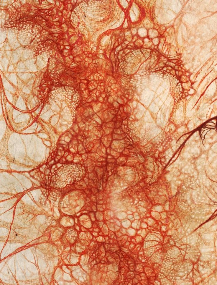 an image of red and white vein on the surface of a human's skin