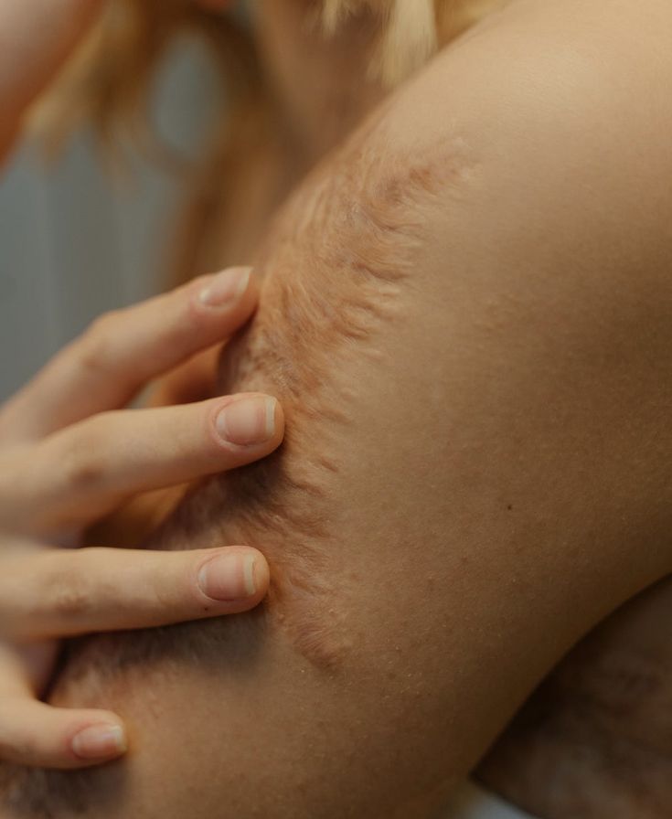 a woman is holding her arm over the back of her body with it's hands