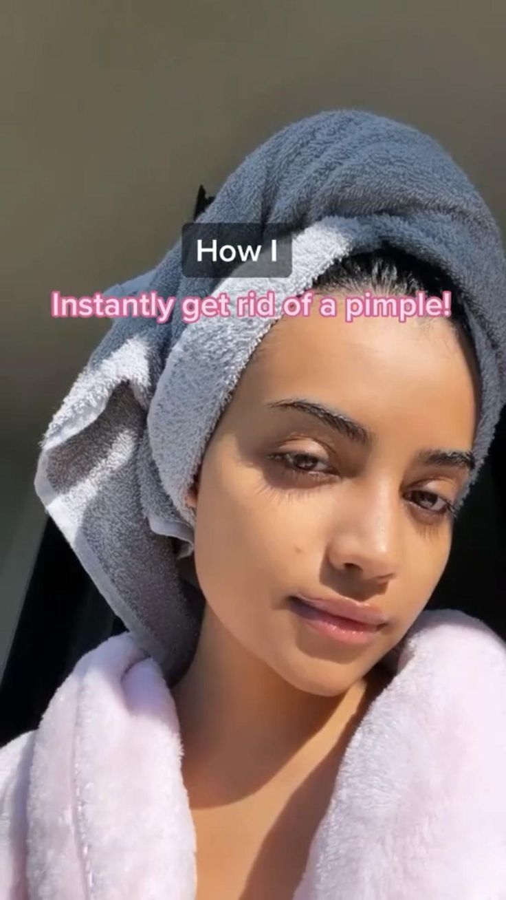 Get Rid of Pimples | Pinterest How To Get Rid Of A Pimple Instantly, How To Get White Hands, Get Rid Of Pimples, Rid Of Pimples, How To Get Rid Of Pimples, Beauty Tips For Glowing Skin, Clear Skin Tips, Live Healthy, Healthy Skin Tips