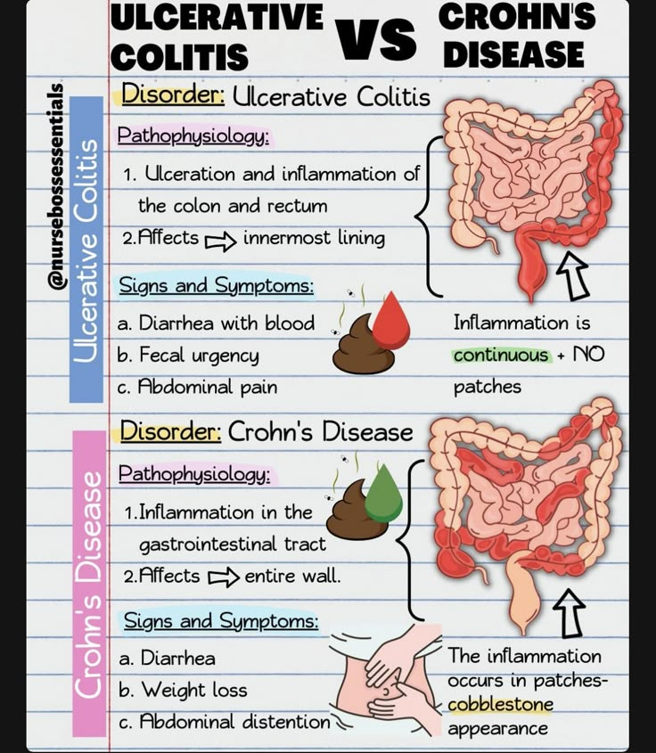 an image of the different types of stomachs and their functions in human health care