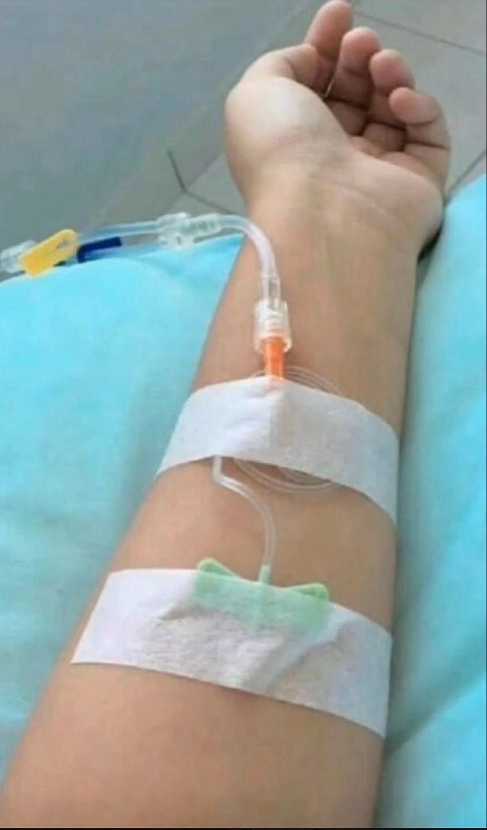 a person in a hospital bed with an iv tube wrapped around their arm and hand