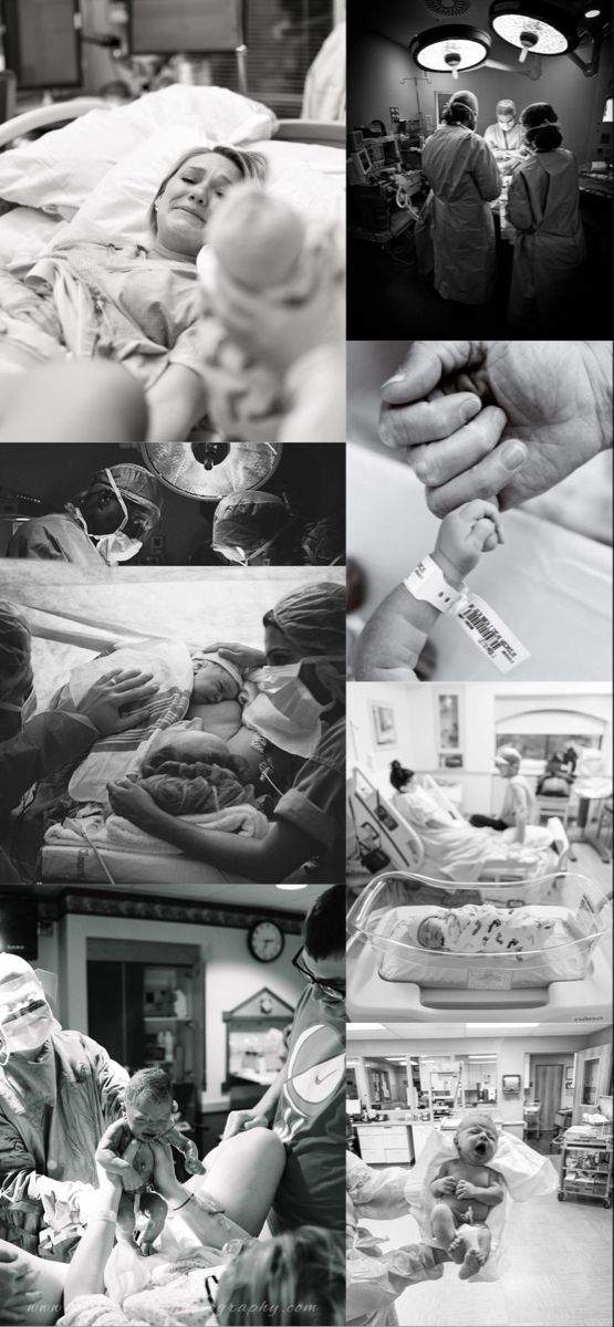 black and white pictures of people in hospital beds, nurses tending to their babys