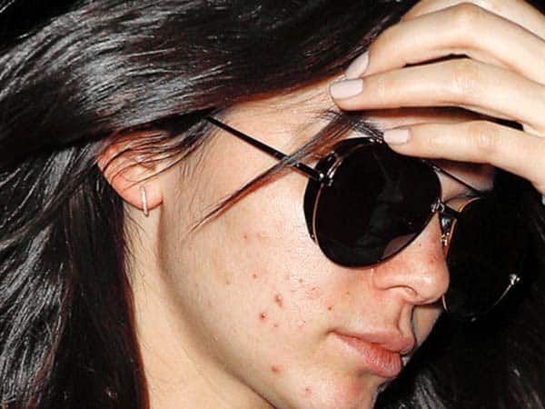 a close up of a person wearing sunglasses with freckles on her hair and holding their hands to the forehead