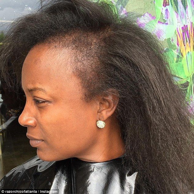 Atlanta hairstylist shares videos of clients suffering from hair loss due to weaves Damaged Black Hair, Razor Chic Of Atlanta, Razor Chic, Short Weave Hairstyles, Alopecia Hairstyles, Tan Skin Blonde Hair, Traction Alopecia, Hair Issues, African American Hairstyles