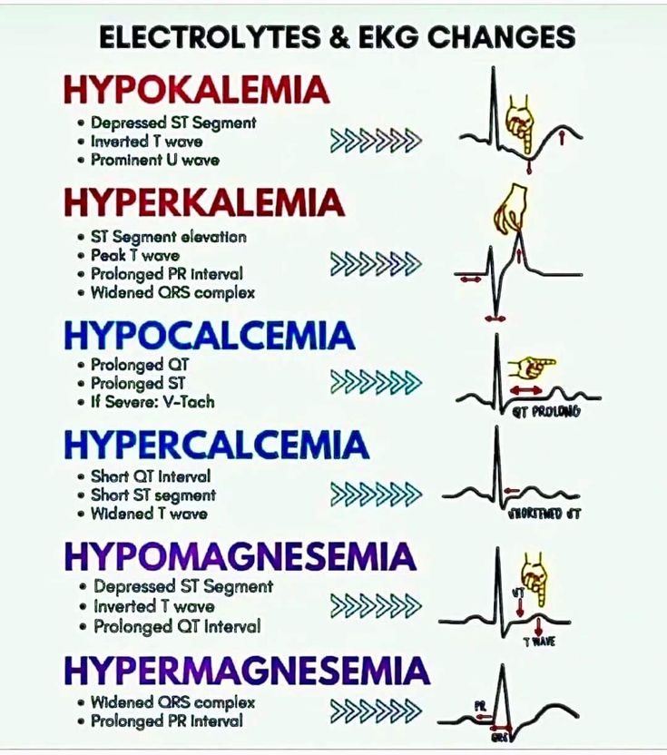 Paramedic Motivation, Er Medicine, Paramedic Tips, Nursing Theories, Ekg Rhythms, Medical Assistant Student, Paramedic School, Nursing School Essential, Nursing School Motivation