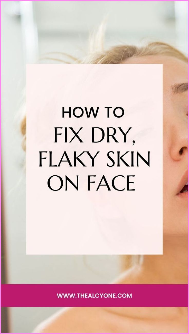 Self-care is not selfish; it's essential. #BeautyTips #skincare #haircare #BeautySecrets Dry Facial Skin Remedy, How To Fix Dry Skin On Face, Dry Patchy Skin On Face, Chapped Face Remedy Skin, Flaky Face Skin, How To Help Dry Skin On Your Face, Dry Forehead Remedies, How To Remove Dry Skin From Face, How To Get Rid Of Dry Flaky Skin On Face