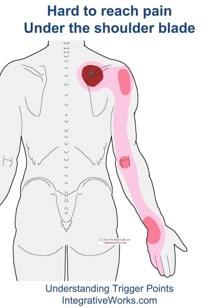 Trigger Points – Vague pain in the back of the shoulder and arm | | Integrative Works Psoas Release, Trigger Point Therapy, Tight Hip Flexors, Psoas Muscle, Upper Back Pain, Ju Jitsu, Neck And Shoulder Pain, Joints Pain Relief, Trigger Points