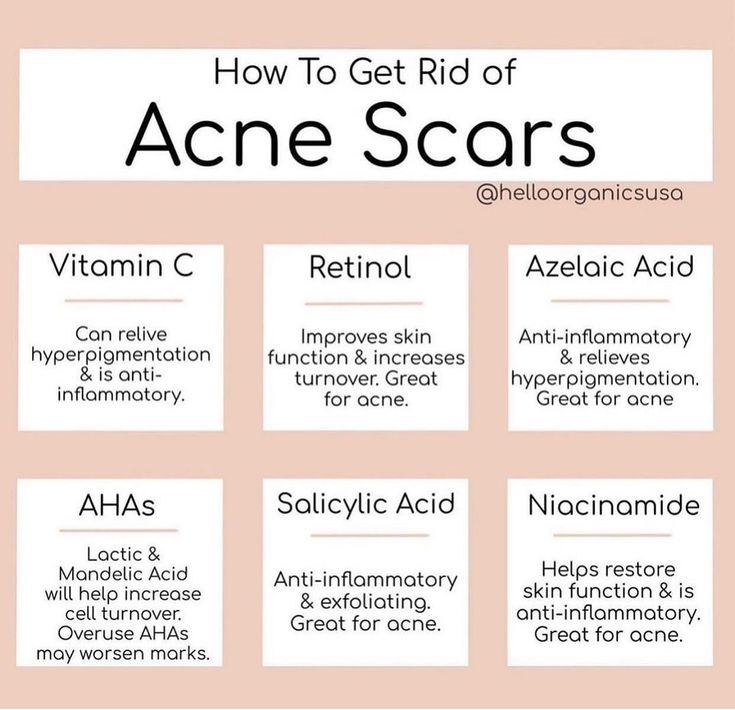 Haut Routine, Skin Facts, Skin Advice, Get Rid Of Acne, Rid Of Acne, Basic Skin Care Routine, How To Get Rid Of Acne, Skin Care Remedies, Skin Routine