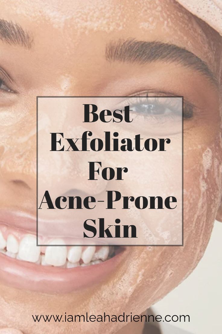 Are you struggling with stubborn acne? It's time to discover your perfect exfoliator match! This article breaks down the best exfoliator for acne-prone skin and helps you create a foolproof routine for your skincare transformation. Ready to say goodbye to acne and hello to clear skin? Read the blog! Skin Care Routine For Hyperpigmentation, Skin Care Products For Teenagers, Best Exfoliator For Face, How To Exfoliate Face, Best Face Exfoliator, Skin Care Routine For Beginners, Acne Prone Skin Care Products, Exfoliating Routine, Skincare Transformation