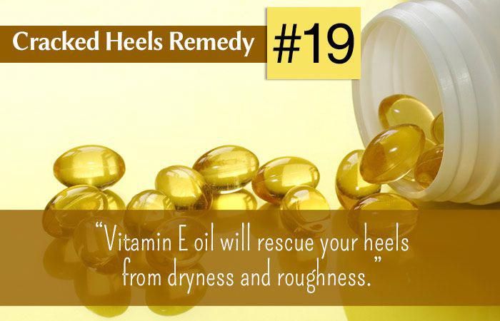 Cracked heels are the result of dry, callused skin on the bottom of your feet.They can be extremely painful. Here is the list of home remedies for cracked heels Dry Feet Remedies, Cracked Heel Remedies, Body Tricks, Skin Tags On Face, Beauty Diy Skincare, Dry Heels, Cracked Heel, Healing Remedies, Face Scrub Homemade