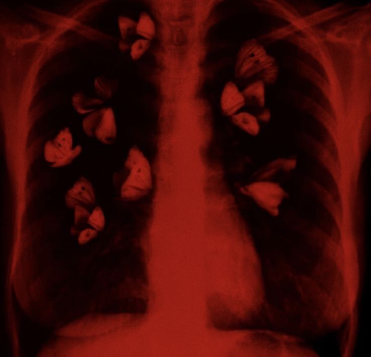 an x - ray image shows the chest and lungs