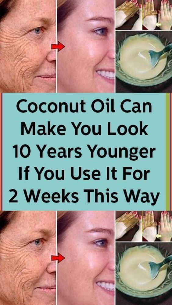 Coconut Oil Can Make You Look 10 Years Younger If You Use It For 2 Weeks This Way#howtoremovewrinklesfromfaceathome #removewrinkles #wrinkles #getridofwrinklesonface #howtogetridofwrinklesonface #removewrinklesonface Wrinkles Remedies Face, Coconut Oil Skin, Dark Spots Remedies, Wrinkles Remedies, Wrinkle Remedies, Coconut Oil Skin Care, Remedies For Skin, Wrinkle Free Skin, Firmer Skin