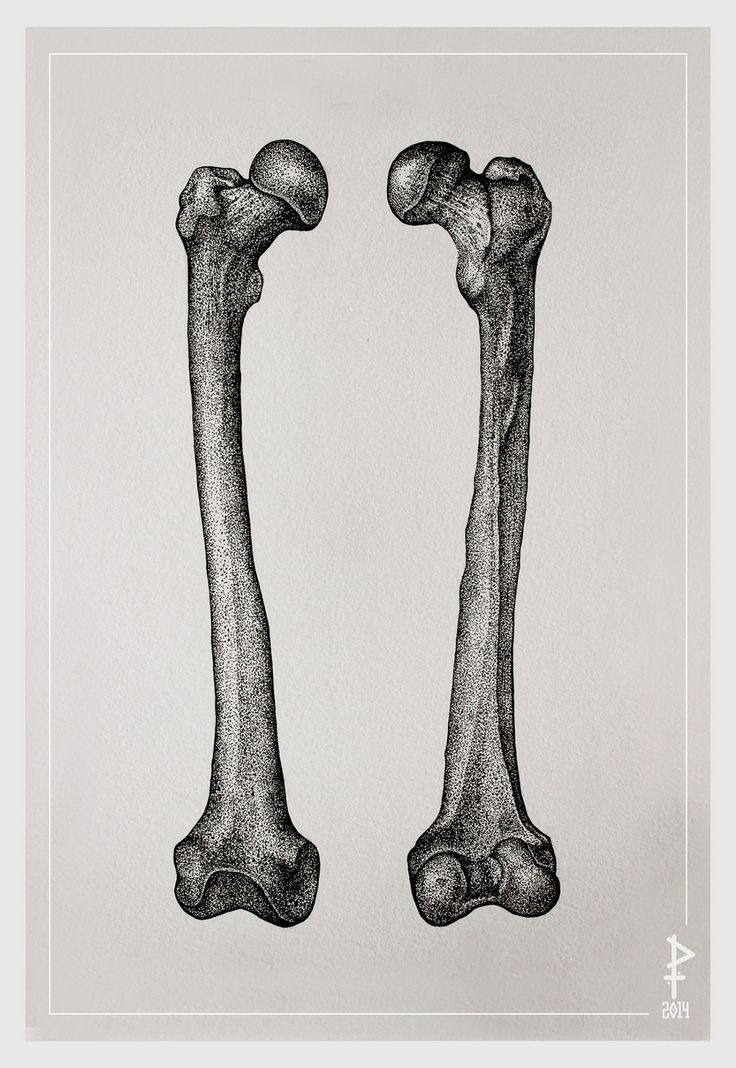 two bones are shown side by side in black and white, with the lower half showing