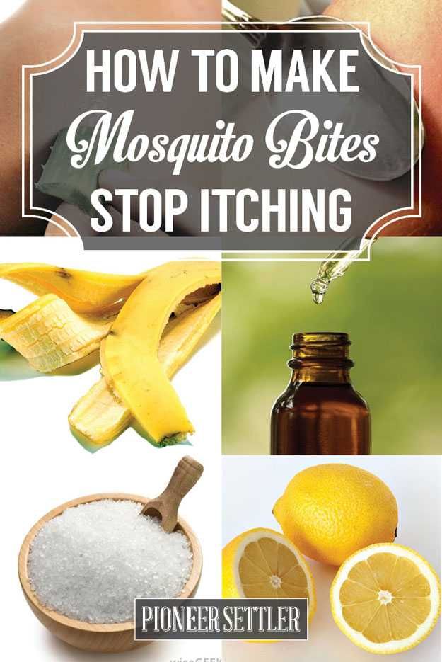 Mosquito Bites Stop Itching, Remedies For Mosquito Bites, Mosquito Bites, Mosquito Bite, Homemade Remedies, Natural Home Remedies, Back To Nature, Natural Home, What’s Going On