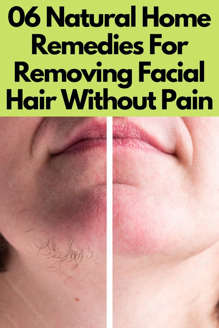 06 Natural Home Remedies For Removing Facial Hair Without Pain Removing Facial Hair Women, Facial Hair Removal Mask, Hair Removal Mask, Removing Facial Hair, Homemade Hair Removal, Diy Facial Hair Removal, Natural Facial Hair Removal, Skin Blackheads, Rare Eye Colors