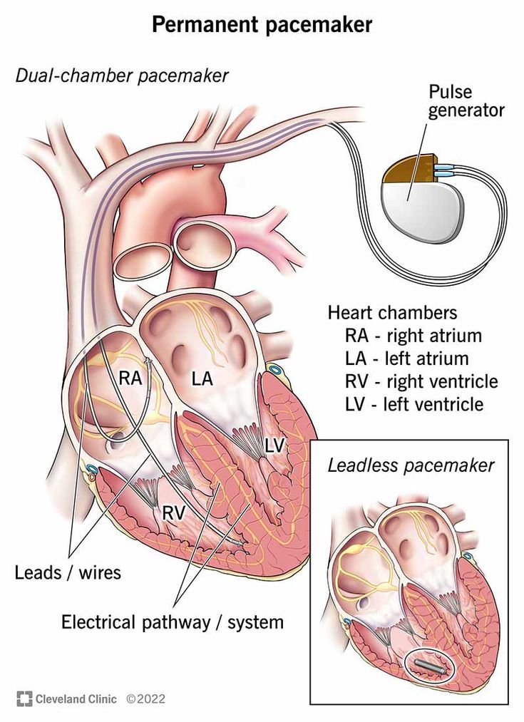 an image of the heart and its valves