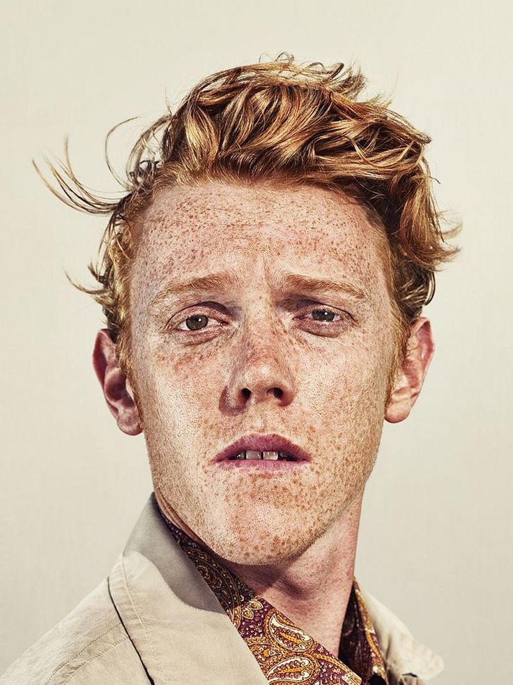 a man with freckles on his face and neck tie