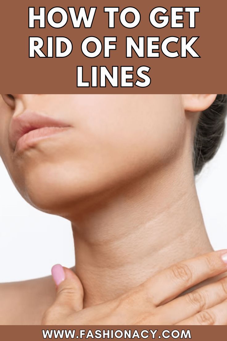 How To Get Rid of Neck Lines Get Rid Of Neck Lines, Remove Neck Lines, Neck Wrinkles Remedies, Natural Wrinkle Remedies, Home Remedies For Wrinkles, Different Types Of Acne, Thick Moisturizer, Neck Lines, Dermatologist Recommended Skincare