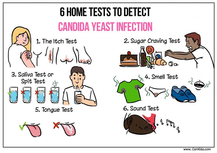 Essential Oils For Candida, Yeast Infection On Skin, Candida Overgrowth Symptoms, Get Rid Of Candida, Chronic Yeast Infection, Candida Symptoms, Candida Yeast Infection, Yeast Infection Symptoms, Yeast Overgrowth