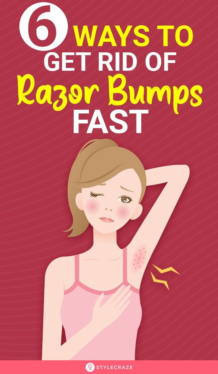 How To Get Rid Of Armpit Bumps, How To Get Rid Of Razor Bumps Down There, Shaving Bumps Remedy, How To Get Rid Of Bumps On Your Vag, How To Get Rid Of Razor Burn Fast, What Helps With Razor Bumps, Armpit Razor Burn Remedies, How To Get Rid Of Shaving Bumps, How To Help Razor Burn