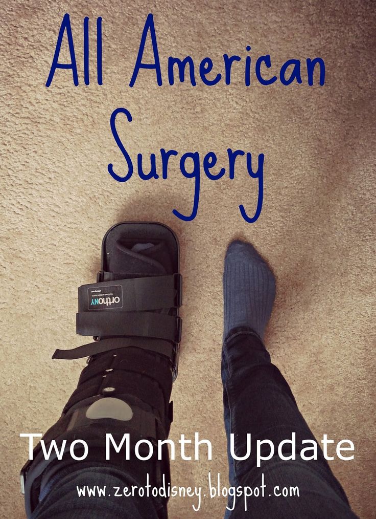 Ankle Break, Ankle Cast, Ankle Surgery Recovery, Broken Ankle Recovery, Ankle Recovery, Cam Boot, Leg Strengthening Exercises, Ankle Ligaments, Ankle Fracture