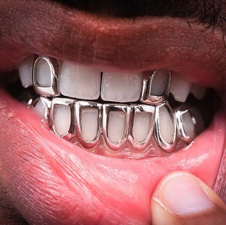 Grillz Teeth Men, Mouth Grills, Girl Grillz, Pretty Teeth, Grillz Teeth, Diamond Teeth, Custom Grillz, Gold Grillz, Grills Teeth