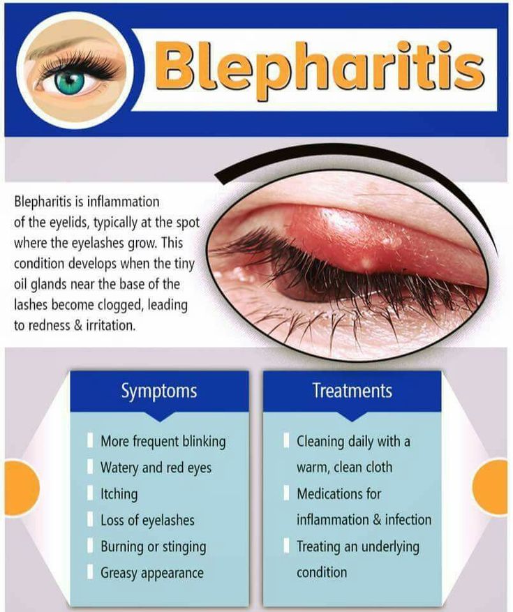 Opthalmic Technician, Optician Training, Eye Health Facts, Optometry Education, Nursing Information, Eye Facts, Eye Anatomy, Basic Anatomy And Physiology, Nursing Mnemonics