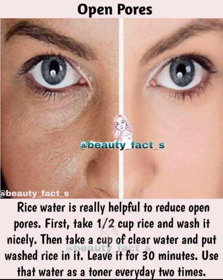 Skin Face Mask, Clear Skin Face, Open Pores, Clear Healthy Skin, Natural Skin Care Remedies, Natural Face Skin Care, Good Skin Tips, Rice Water, Beauty Tips For Glowing Skin