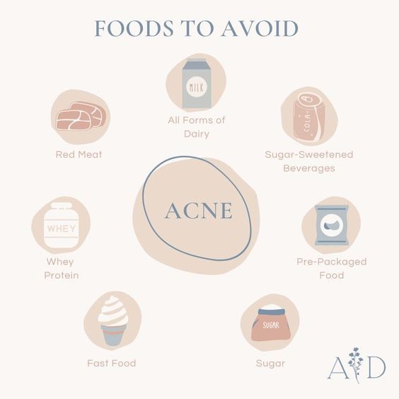 foods to avoid for acne, heal your skin, acne Foods To Clear Acne, For Acne Skincare, Food For Acne, Acne Causing Foods, Foods For Clear Skin, Clear Skin Diet, Health Aesthetic, Aesthetic Health, Skin Advice