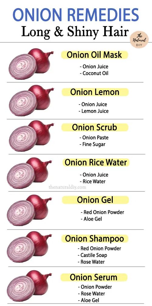 Hair Growth And Shine Tips, Onion Oil For Hair Growth Diy, Onion Hair Mask For Hair Growth, How To Make Onion Oil For Hair Growth, Onion For Hair Growth How To Use, Onions For Hair Growth, Onion Oil For Hair Growth, Shiny Hair Diy, Onion Juice For Hair Growth