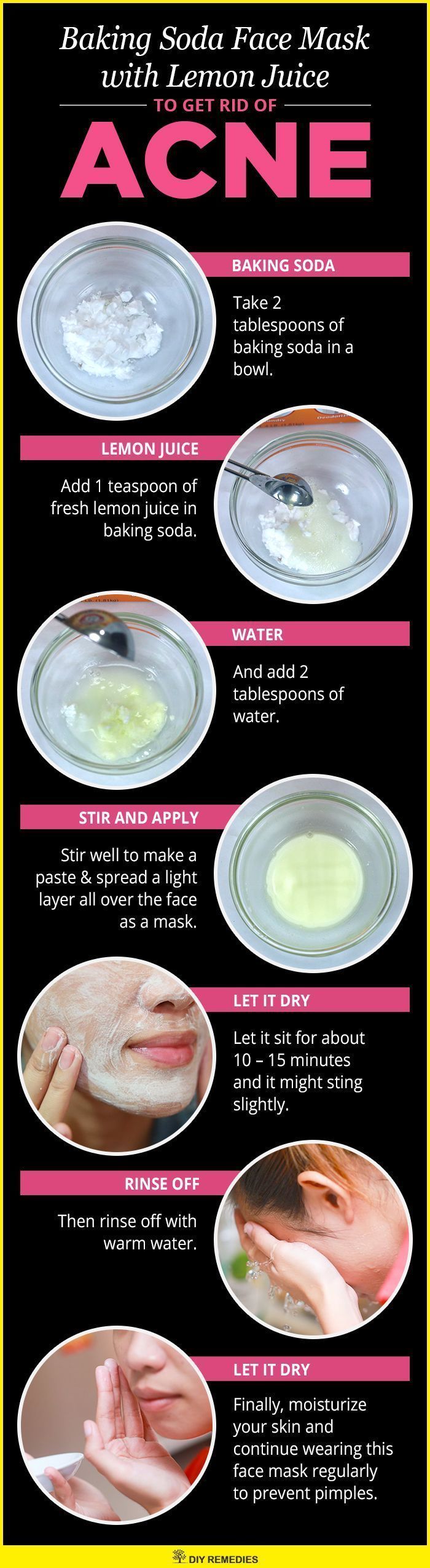 Face Masks For Acne, Masks For Acne, Baking Soda For Acne, Baking Soda Face Mask, Obličejové Masky, Baking Soda Face, Homemade Facial Mask, Skin Face Mask, Acne Face Mask