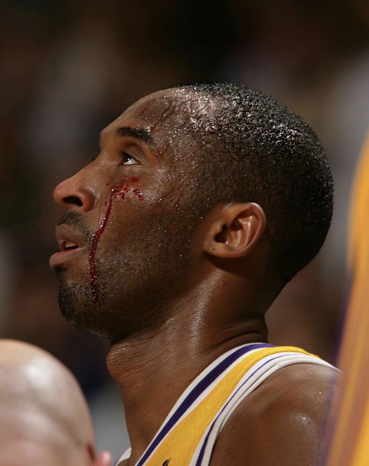 a close up of a basketball player with blood on his face