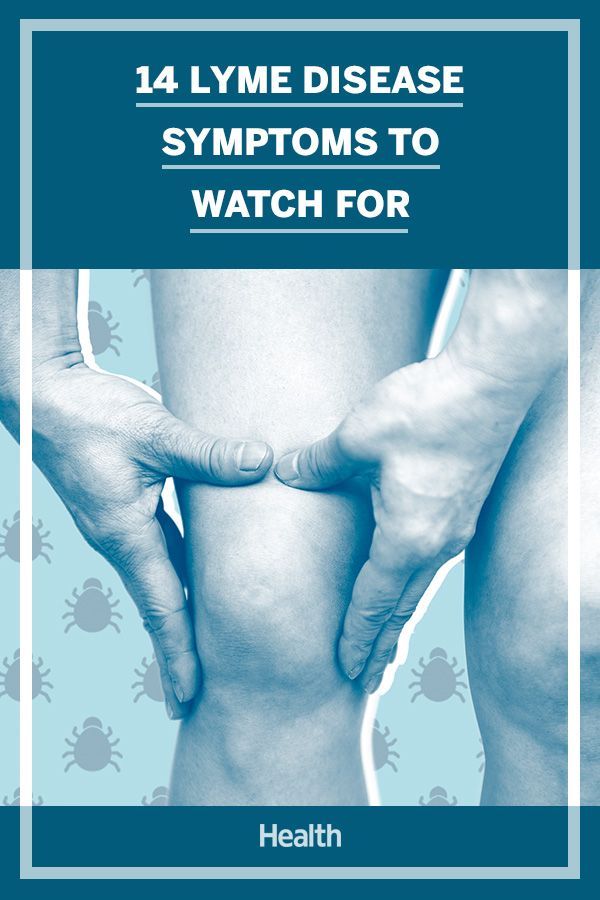 Symptoms of Lyme disease in humans can be vague, and chances are you have no idea you’ve been bitten by an infected tick until symptoms surface. Knowing the symptoms to look for can help diagnose Lyme disease early on, when it's easily treatable. #lymedisease #health Ticks On Humans, Autoimmune Disease Symptoms, Swollen Knee, Medical Laboratory Science, Disease Symptoms, Nerve Pain, You Have No Idea, Autoimmune Disease, Knee Pain